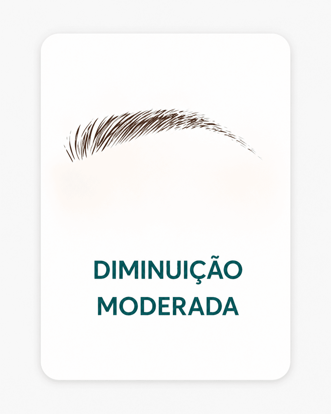 Sobrancelha tipo 3 - Queda severa