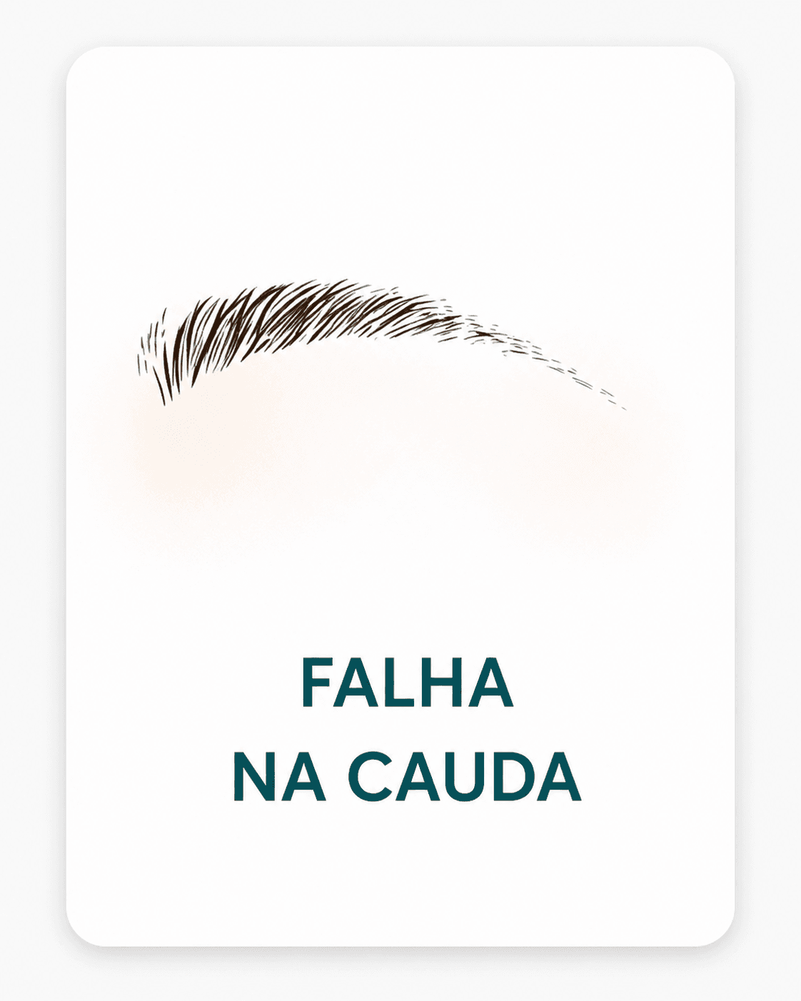 Sobrancelha tipo 5 - Queda extrema